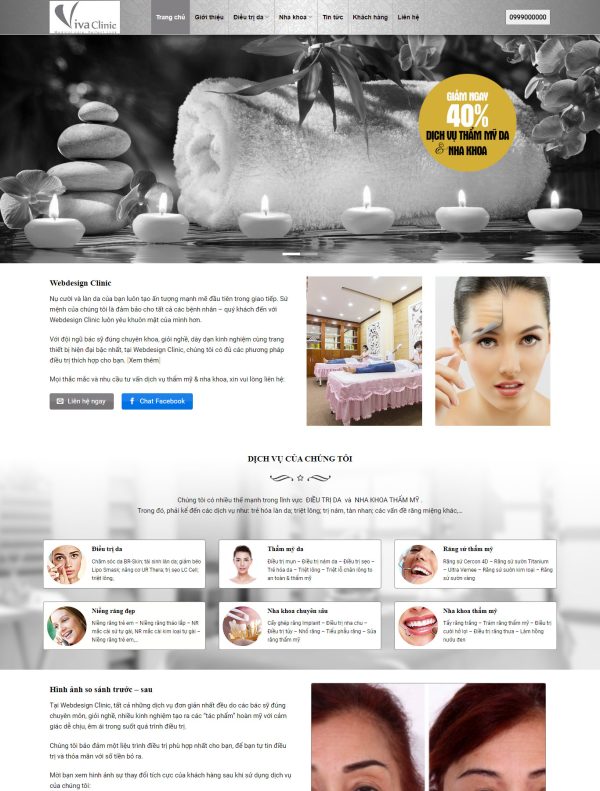 Mẫu Giao diện website Làm đẹp - Thẩm mỹ viện - Spa
