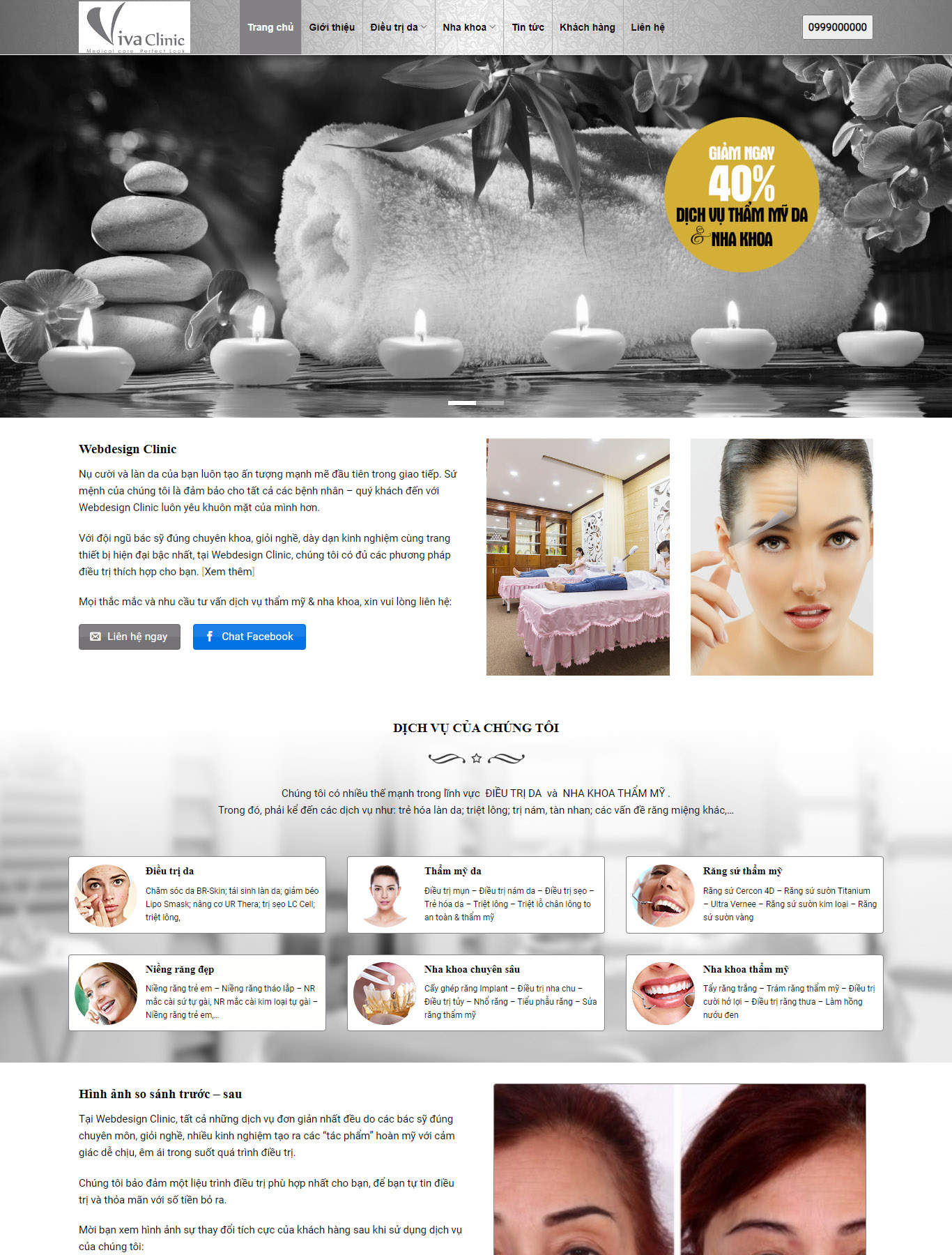 Mẫu Giao diện website Làm đẹp - Thẩm mỹ viện - Spa